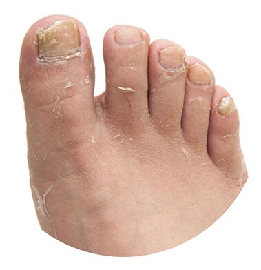 Pieds Champignonaux