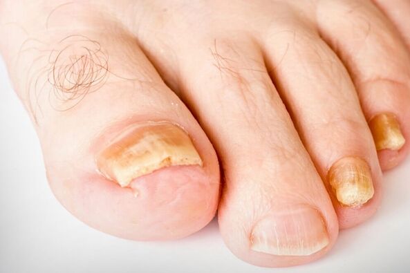 La troisième étape du Nagelhirb