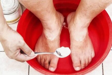 Traitement du champignon sur le pouce de la jambe