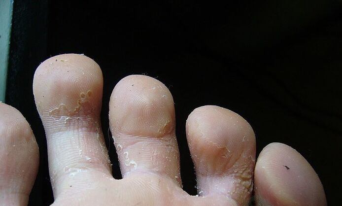 Stade initial du champignon